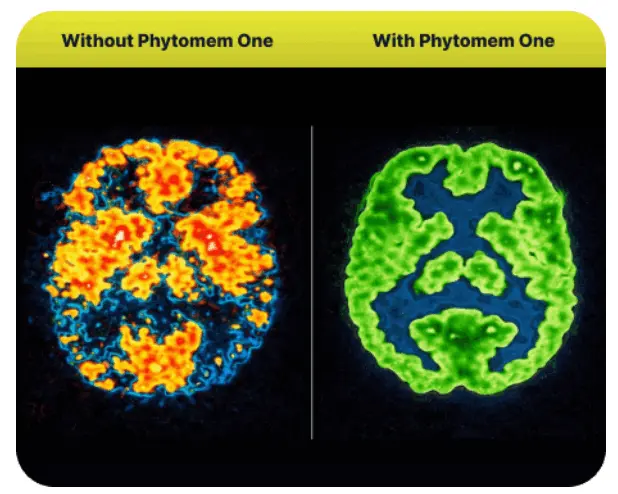 Phytomem One brain before and after